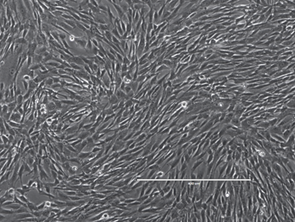 Human stem cells of perinatal and endometrium origin