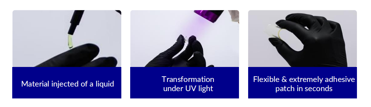 PHOTOBIOCURE – injectable implants for soft tissue repair
